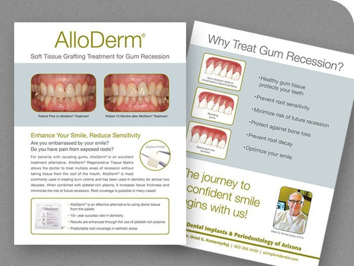 AlloDerm Procedure Info Sheet AlloDerm Procedure Info Sheet